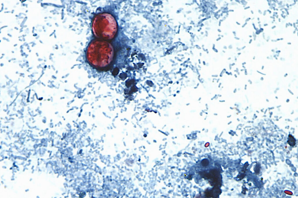 MCHD: Six local cyclosporiasis cases, no 'strong link' to Taco Bell